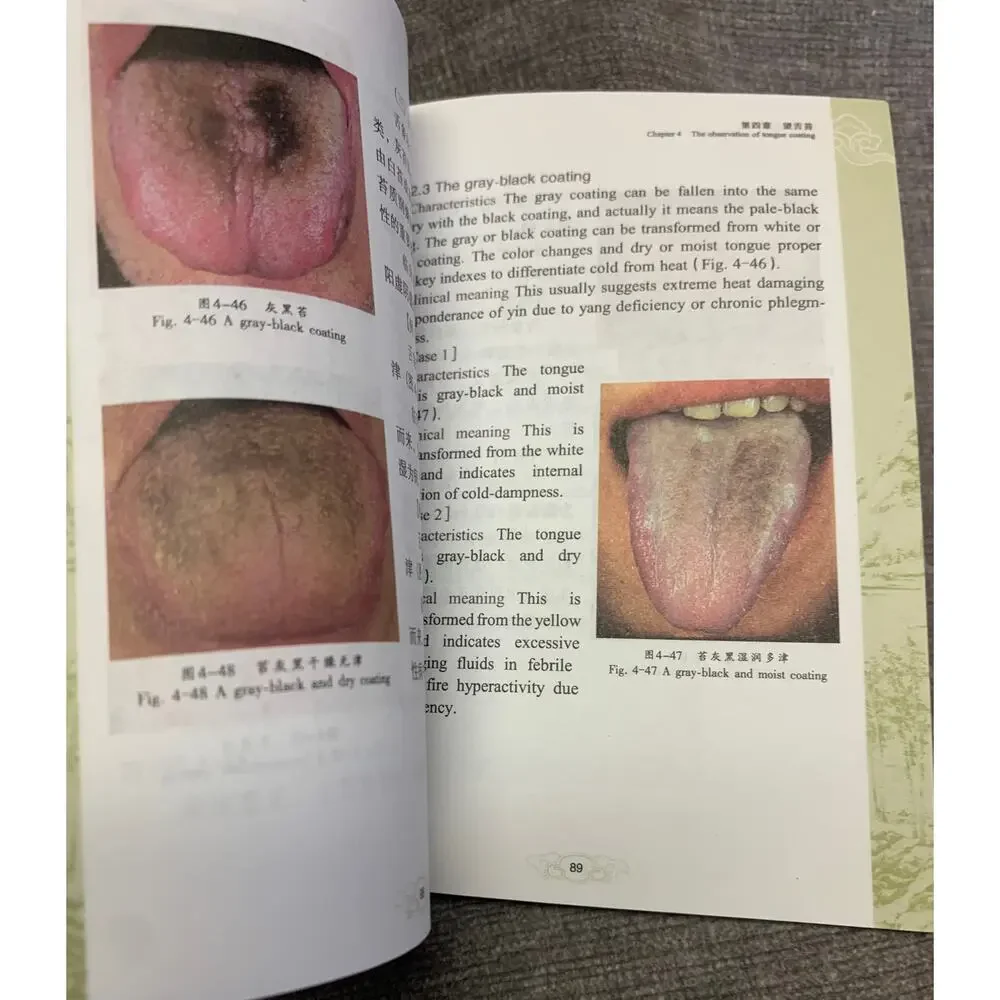 Illustrations of Tongue Diagnosis - Traditional Chinese Medicine TCM Pocket Edit